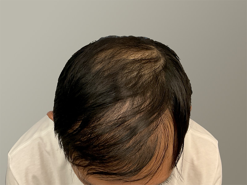 After