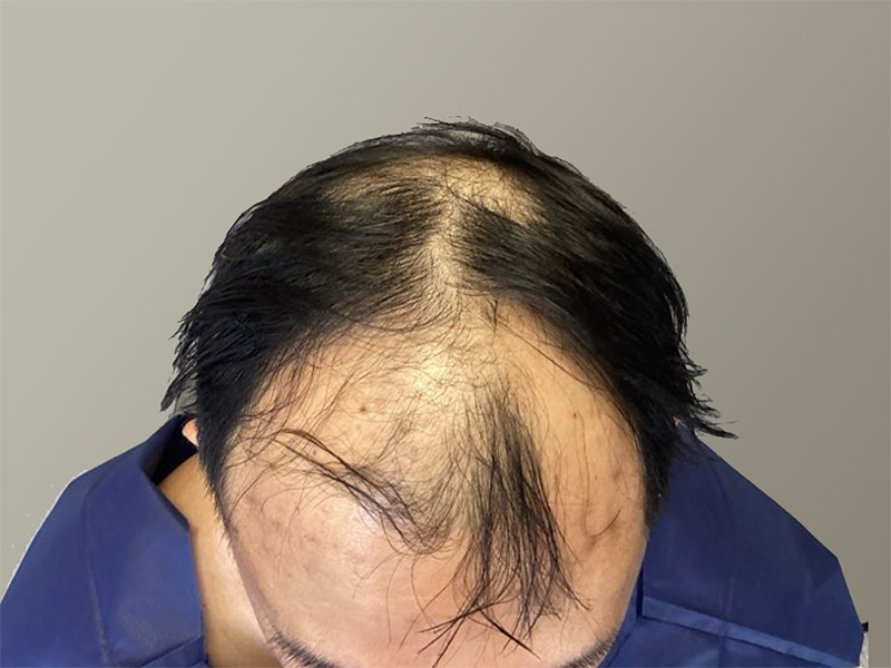 Before
