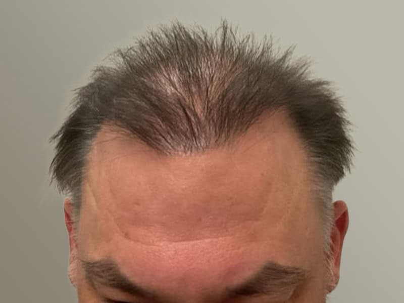 After