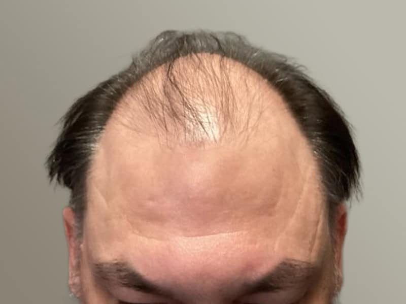 Before